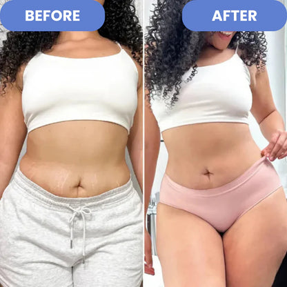 UltraSlim™- Ultrasonic Fat & Cellulite Burner