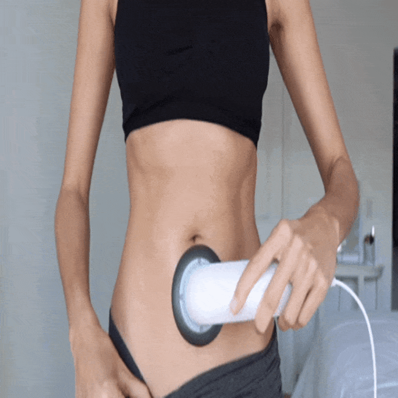 UltraSlim™- Ultrasonic Fat & Cellulite Burner